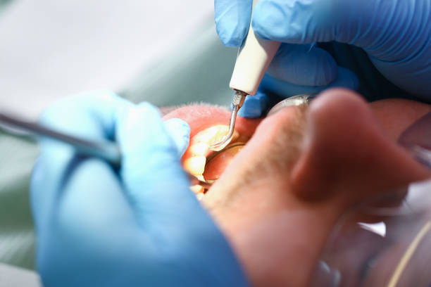 Best Emergency Tooth Extraction  in Camp Croft, SC