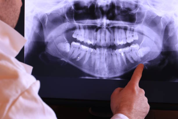Best Chipped Tooth Repair Near Me  in Camp Croft, SC