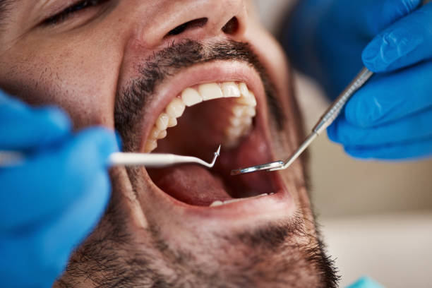 Best Dentist for Dental Trauma  in Camp Croft, SC